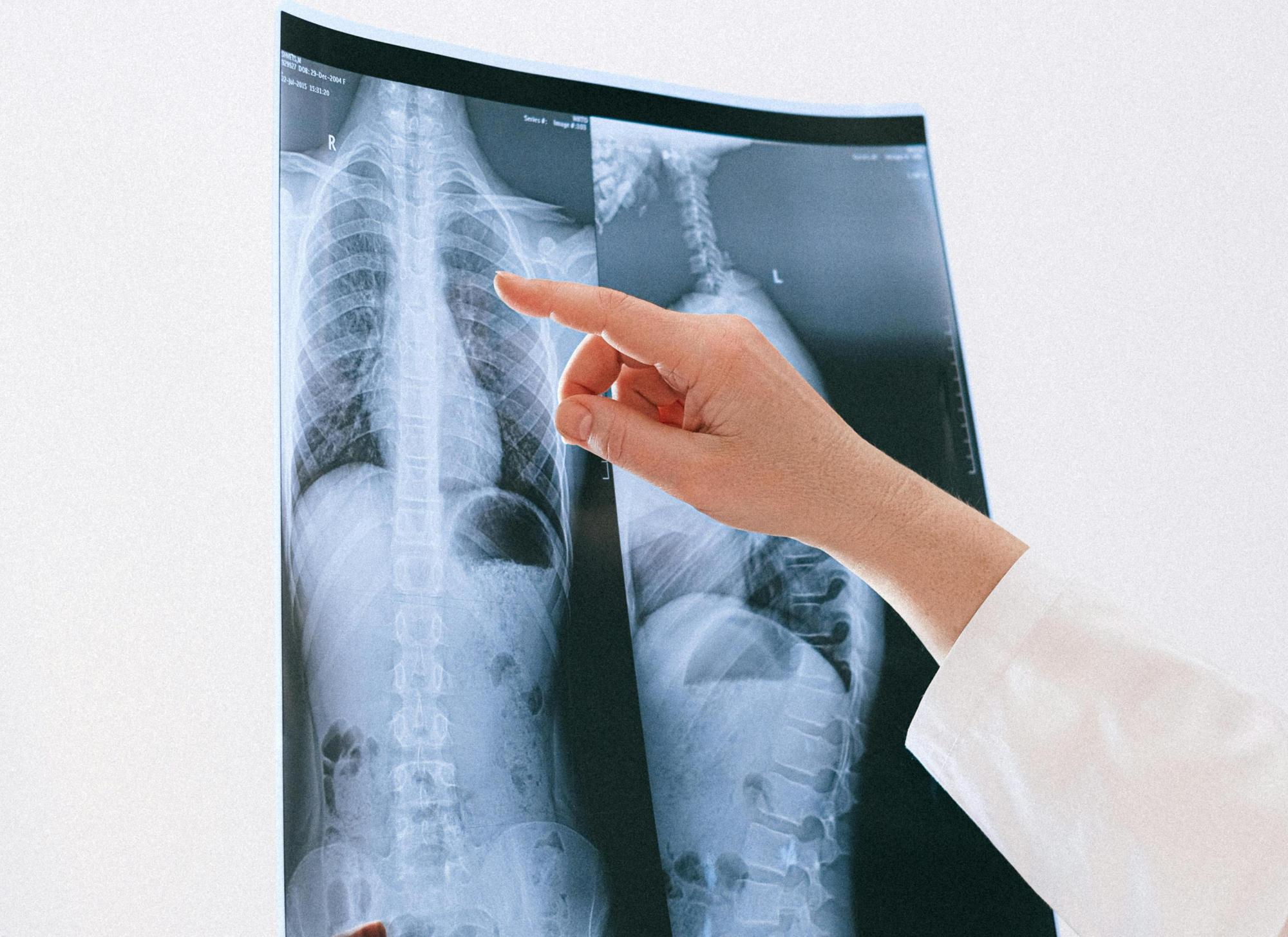 Phthisiology (adult, children's)